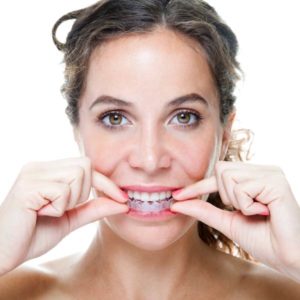 woman putting invisalign aligner in mouth